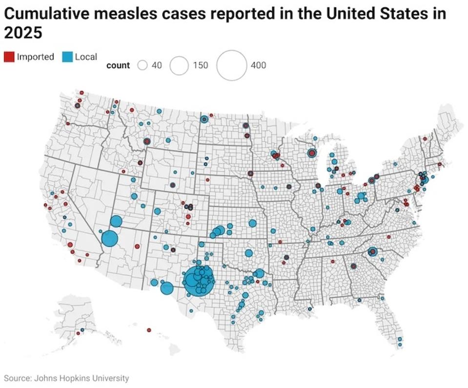 What To Know About Measles Outbreaks And Their Impact On Children